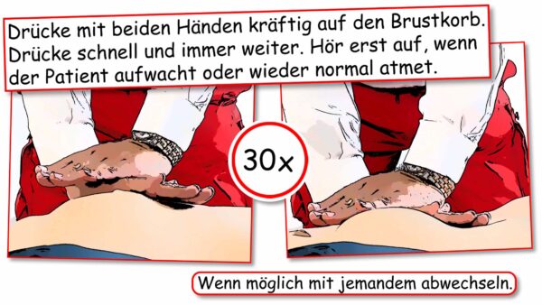Herz-Druck-Massage: Herz-Druck-Massage 30 MAL